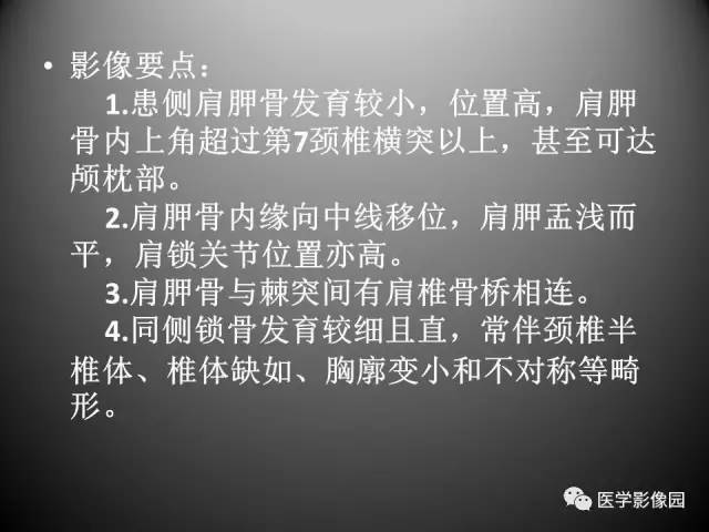 【病例】先天性肩胛骨高位症1例CT影像表现