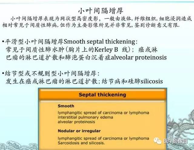 【PPT】肺部HRCT基本影像征象