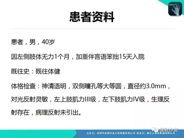【病例】中枢神经系统淋巴瘤1例影像讨论