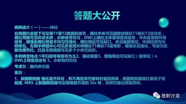 【病例】中枢神经系统淋巴瘤1例影像讨论