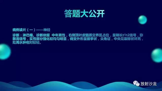 【病例】中枢神经系统淋巴瘤1例影像讨论
