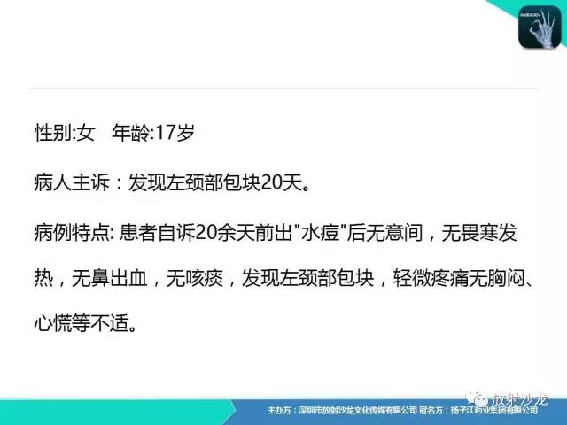 【病例】颈部巨淋巴结增生症Castleman病1例