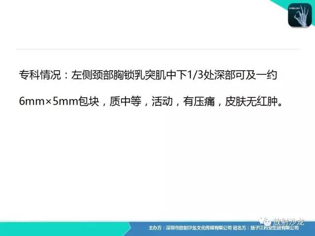 【病例】颈部巨淋巴结增生症Castleman病1例