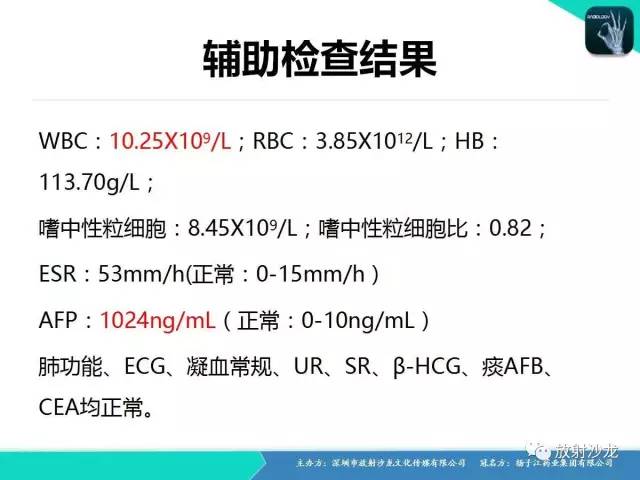 【病例】纵隔生殖细胞肿瘤(内胚窦瘤/卵黄囊瘤)1例CT