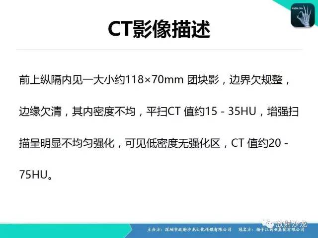 【病例】纵隔生殖细胞肿瘤(内胚窦瘤/卵黄囊瘤)1例CT