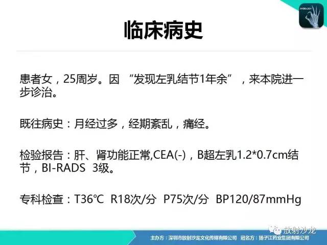 【病例】卵巢硬化性间质瘤1例CT