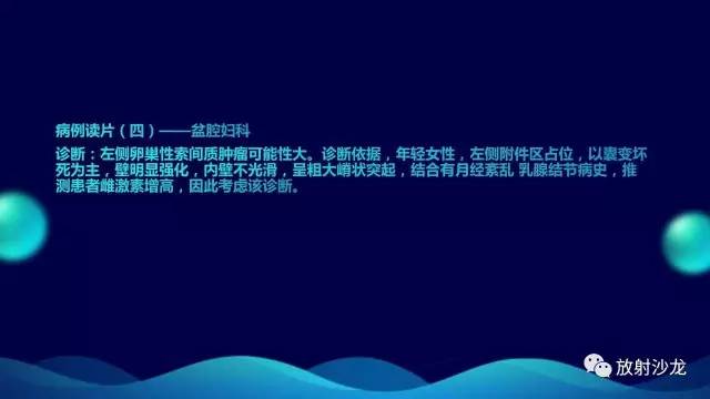【病例】卵巢硬化性间质瘤1例CT