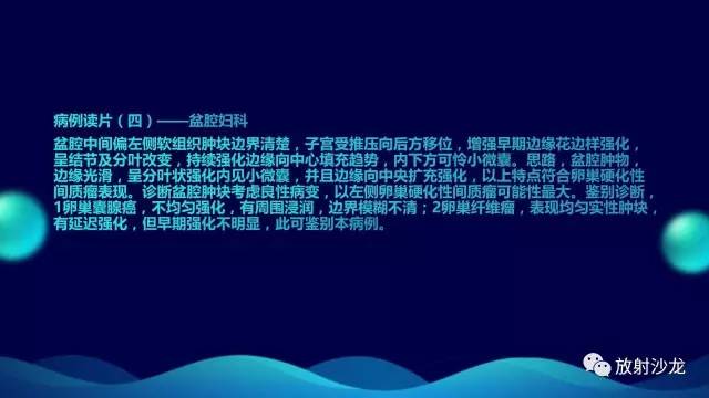 【病例】卵巢硬化性间质瘤1例CT