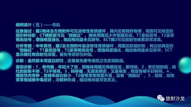 【病例】腰椎孤立性浆细胞性骨髓瘤1例CT及MR
