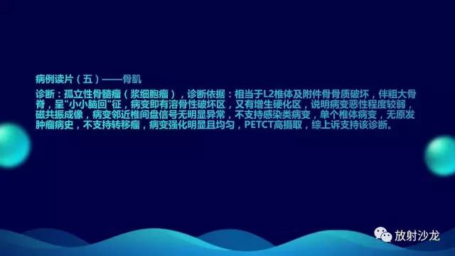 【病例】腰椎孤立性浆细胞性骨髓瘤1例CT及MR