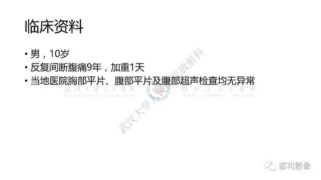 【病例】先天性肠旋转不良伴扭转1例X线CT
