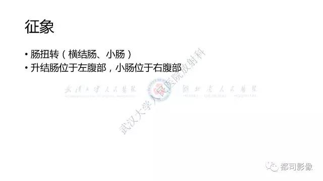 【病例】先天性肠旋转不良伴扭转1例X线CT