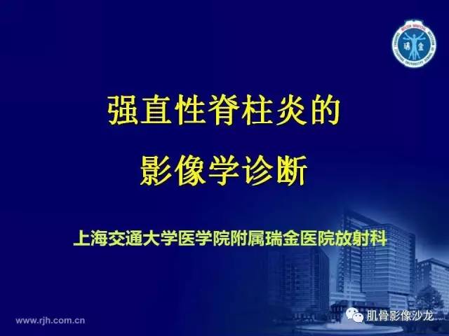 【PPT】强直性脊柱炎的影像学诊断
