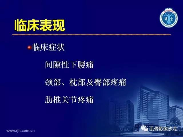 【PPT】强直性脊柱炎的影像学诊断