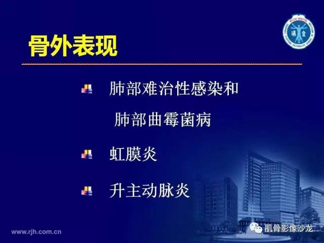 【PPT】强直性脊柱炎的影像学诊断