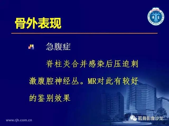【PPT】强直性脊柱炎的影像学诊断