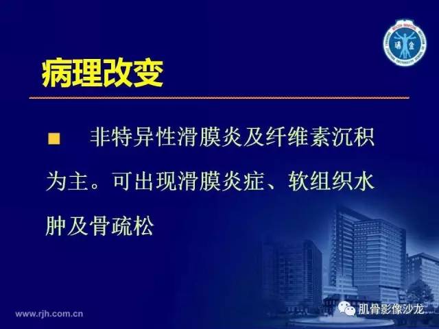 【PPT】强直性脊柱炎的影像学诊断