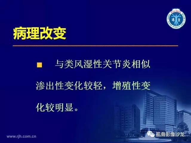 【PPT】强直性脊柱炎的影像学诊断