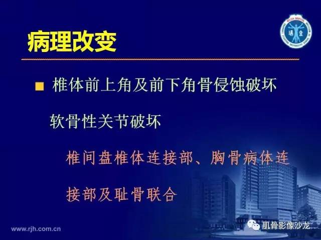 【PPT】强直性脊柱炎的影像学诊断