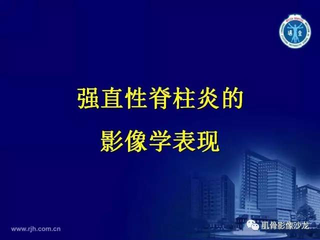 【PPT】强直性脊柱炎的影像学诊断