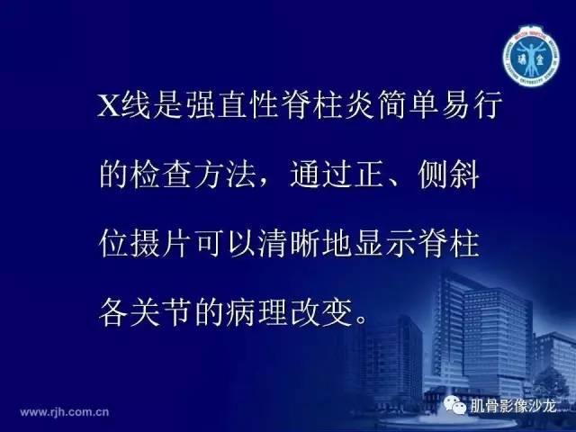 【PPT】强直性脊柱炎的影像学诊断