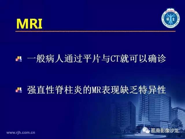 【PPT】强直性脊柱炎的影像学诊断