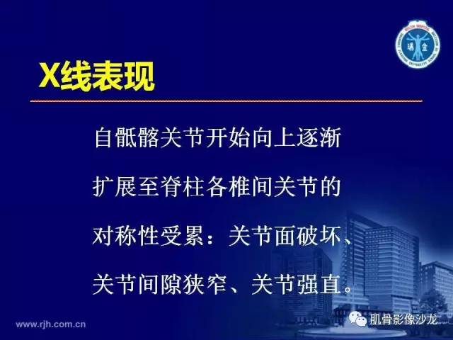 【PPT】强直性脊柱炎的影像学诊断