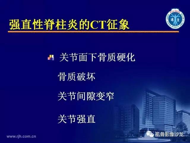 【PPT】强直性脊柱炎的影像学诊断