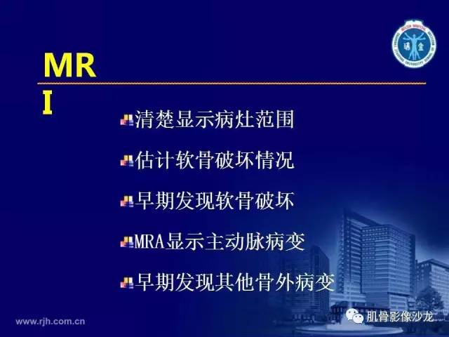 【PPT】强直性脊柱炎的影像学诊断