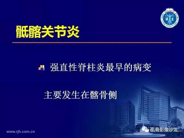 【PPT】强直性脊柱炎的影像学诊断
