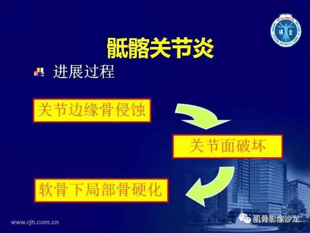 【PPT】强直性脊柱炎的影像学诊断