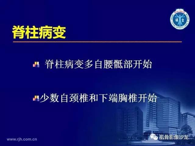 【PPT】强直性脊柱炎的影像学诊断
