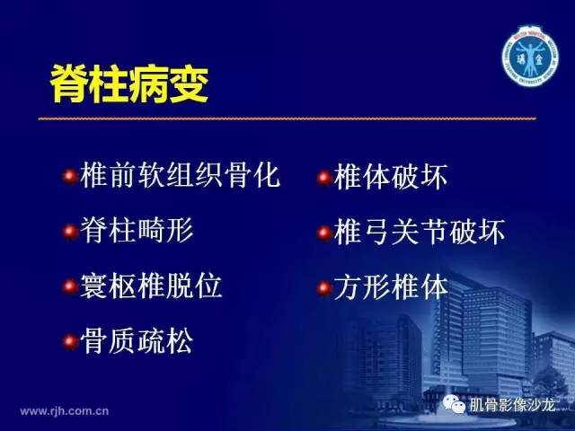 【PPT】强直性脊柱炎的影像学诊断