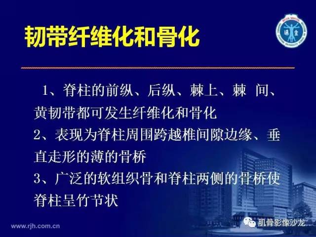 【PPT】强直性脊柱炎的影像学诊断