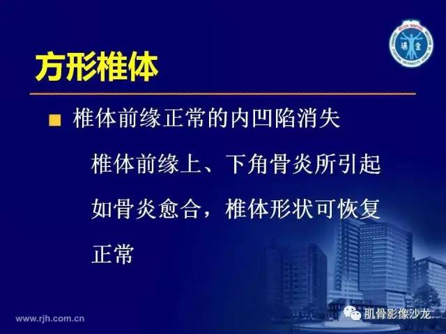 【PPT】强直性脊柱炎的影像学诊断