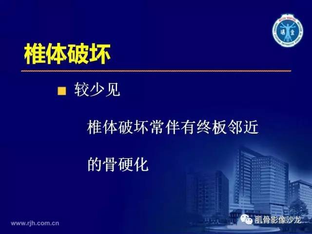 【PPT】强直性脊柱炎的影像学诊断