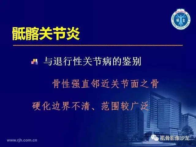 【PPT】强直性脊柱炎的影像学诊断