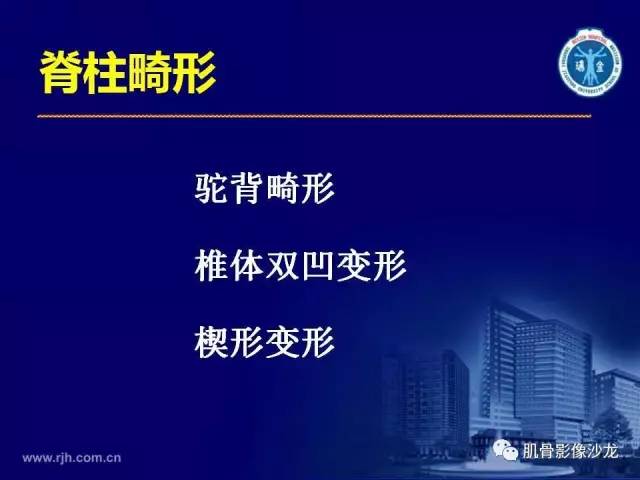 【PPT】强直性脊柱炎的影像学诊断