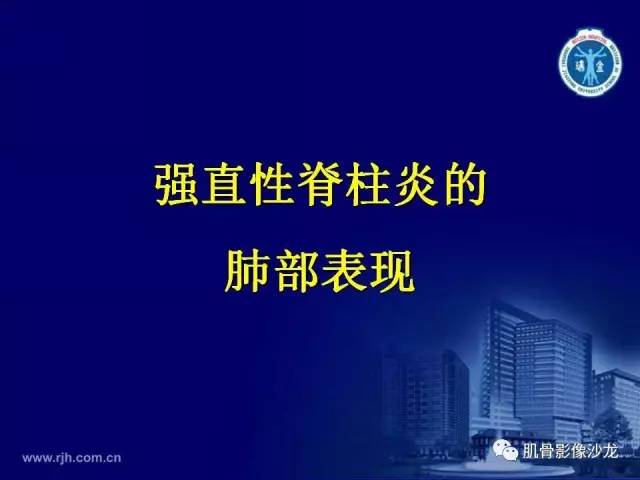 【PPT】强直性脊柱炎的影像学诊断