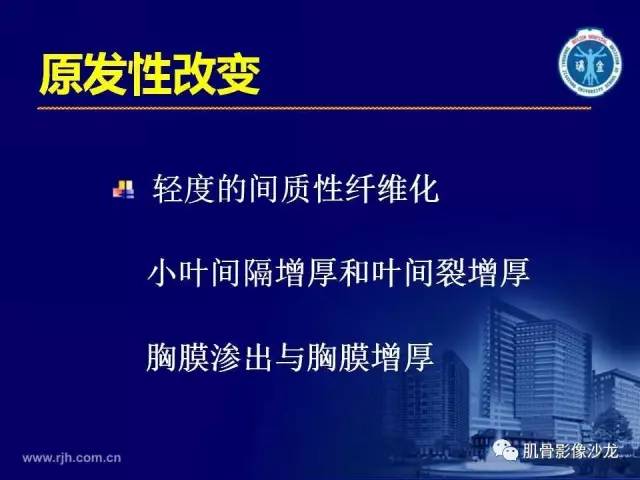 【PPT】强直性脊柱炎的影像学诊断