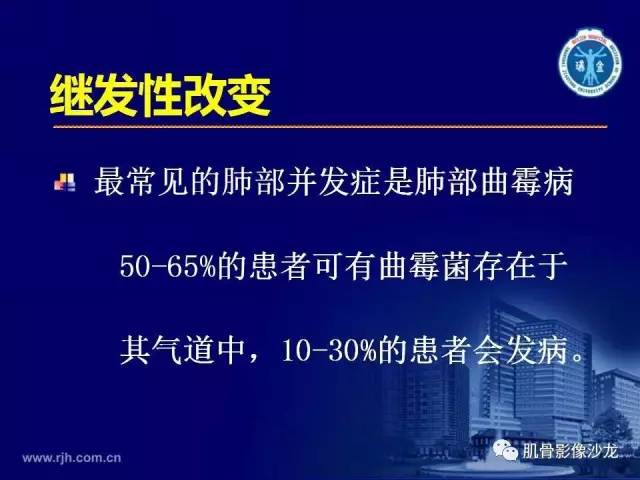 【PPT】强直性脊柱炎的影像学诊断