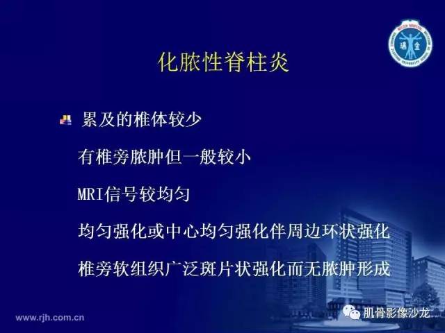 【PPT】强直性脊柱炎的影像学诊断
