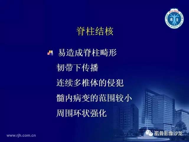 【PPT】强直性脊柱炎的影像学诊断