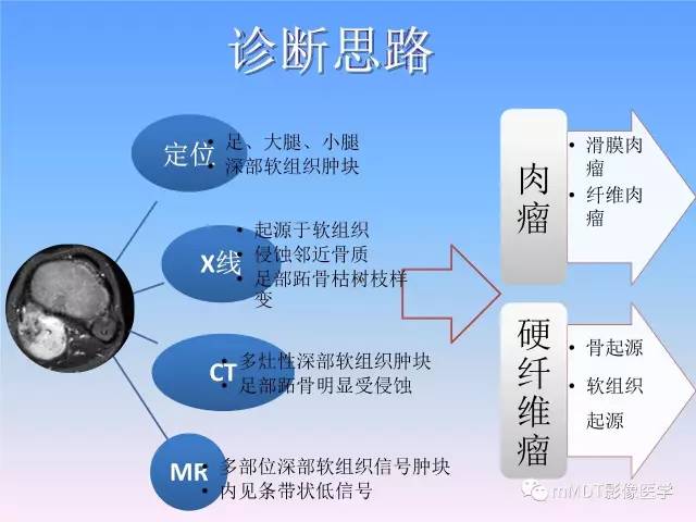 【PPT】韧带样纤维瘤病的影像分析