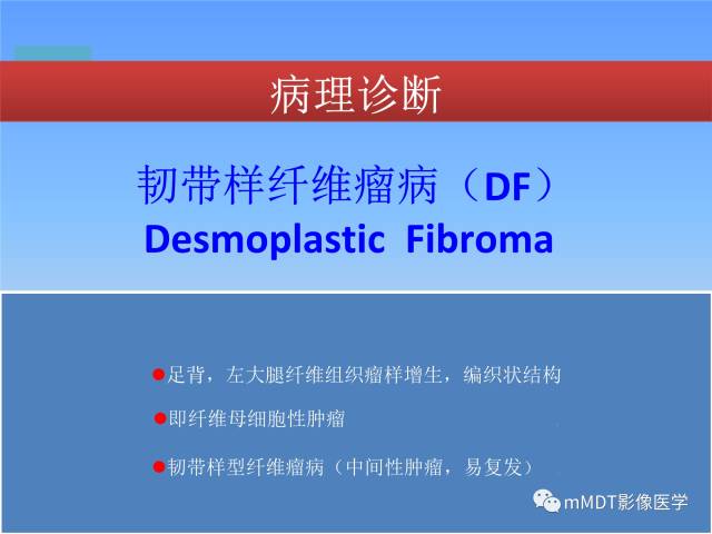 【PPT】韧带样纤维瘤病的影像分析