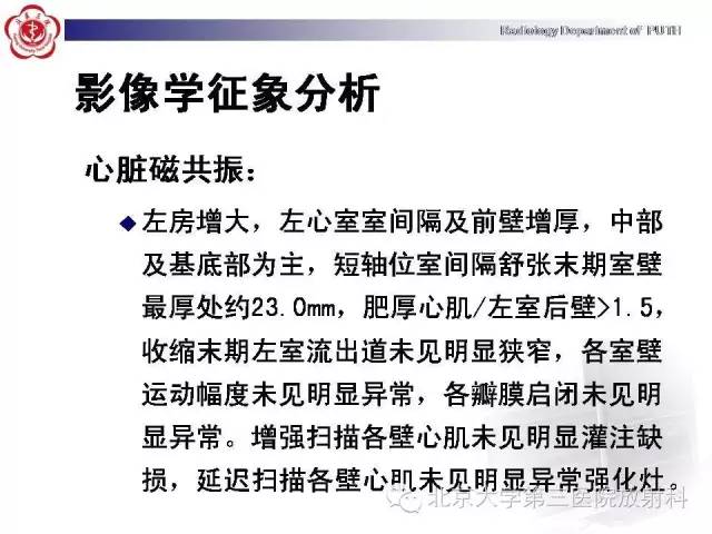 【病例】肥厚性心肌病1例MR影像表现