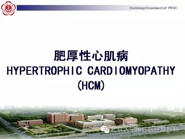 【病例】肥厚性心肌病1例MR影像表现
