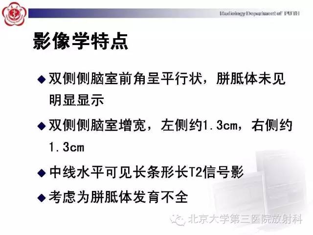 【病例】胎儿胼胝体发育不全1例MR