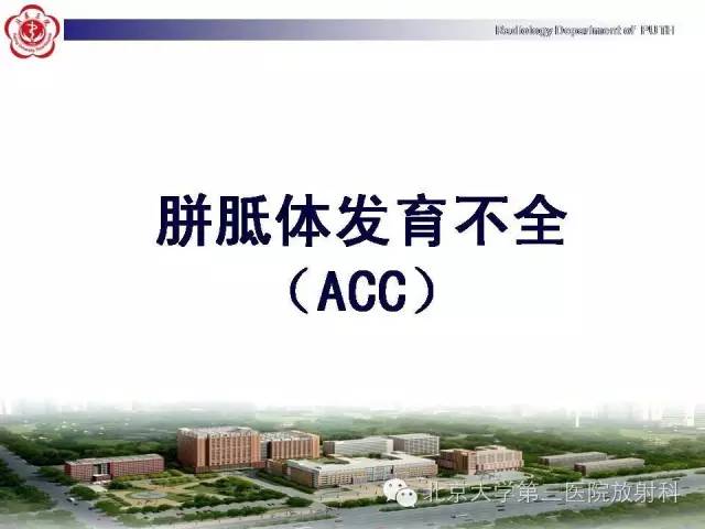 【病例】胎儿胼胝体发育不全1例MR