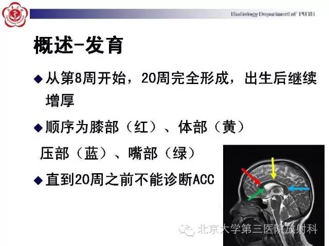 【病例】胎儿胼胝体发育不全1例MR
